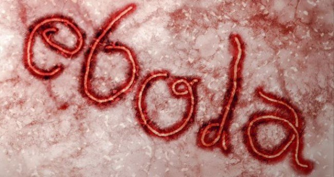 Cegah Ebola, Sime Darby Sumbang 5,7 Juta Sarung Tangan Ke Liberia