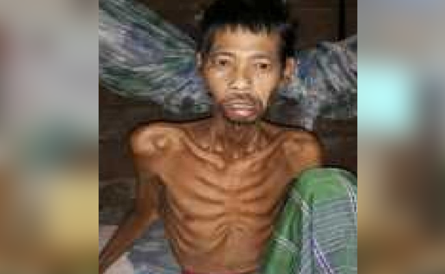 Terkena Racun, Karyawan Semprot PT Agro Andalan Berujung Maut
